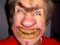 http://www.welaf.com/13415,ugliest-teeth.html